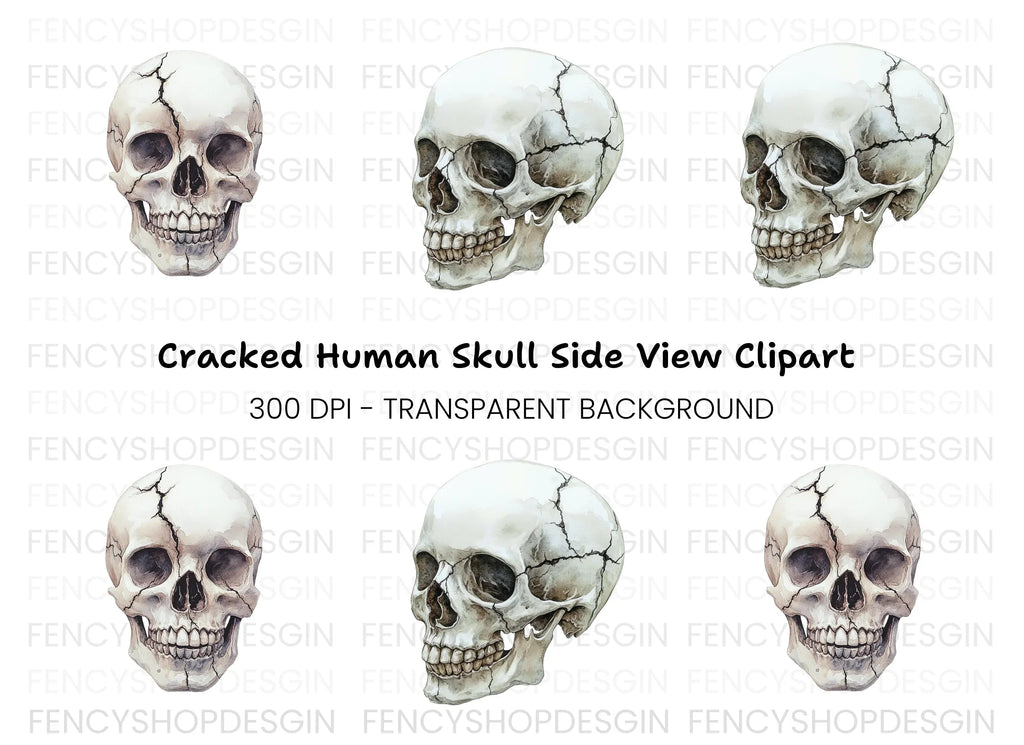 Cracked Skull Side View Clipart Bundle